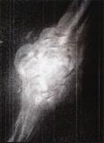 Grainy photo of the explosion of the Ark II